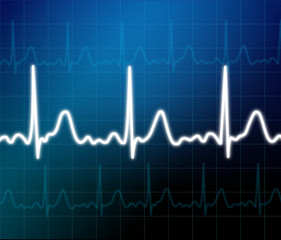 Naklejka premium Illustration of electrical activity of the human heart