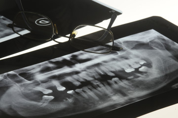 Ortopantomografia panoramica - obrazy, fototapety, plakaty