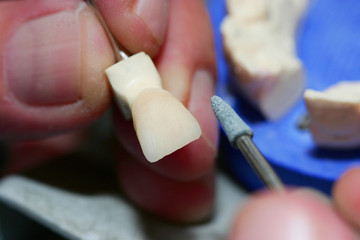 Laboratorio odontotecnico (4)