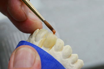 Laboratorio odontotecnico (1)