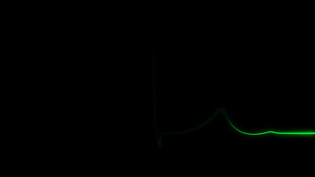 Electrocardiogram displaying heartbeat or pulse 60 bpm