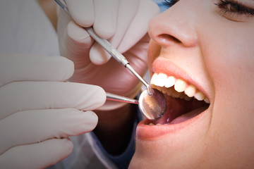 dental checkup