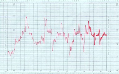 Oscilloscope paper with a diagram drawn on it.