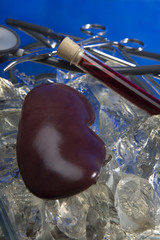 Organ transplantation