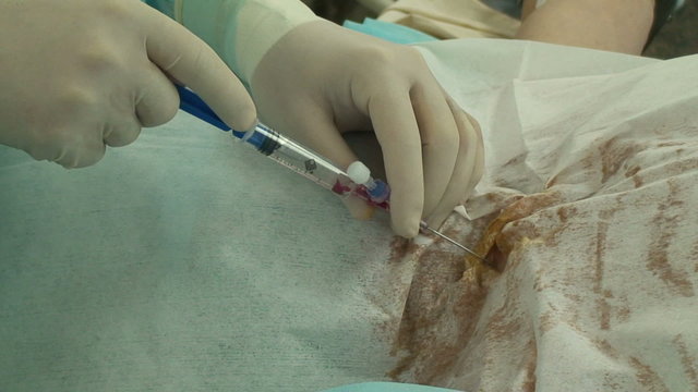Central vein puncture and catheterization in operation room