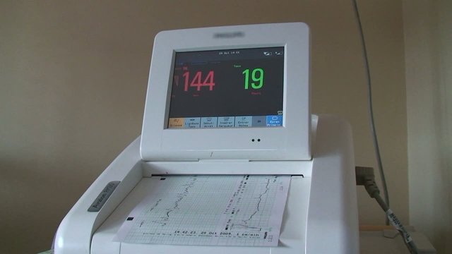 monitoring 1