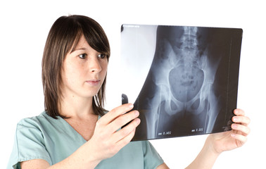 médecin qui observe une radio du bassin