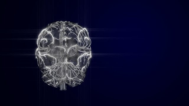 Brain with Vertebralis & Carotis - loop