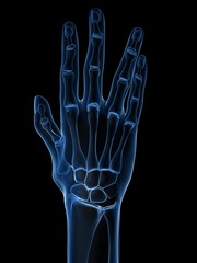 Röntgenaufnahme - Arthritis in den Fingergelenken