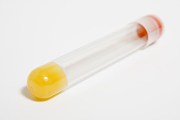 test tube
