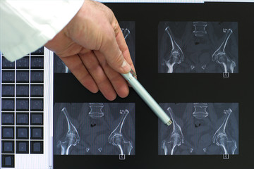 Computertomographie des Beckens