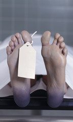 Leichenfuss Autopsie