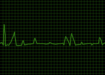 Naklejka premium EKG
