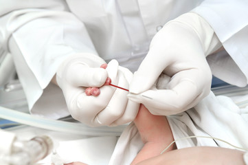 newly-born child blood sampling