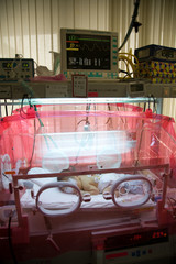 保育器の中の新生児