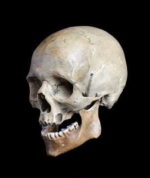 Skull of the person