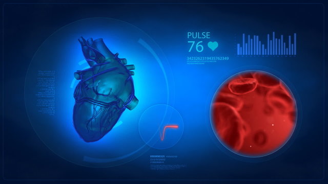 Medical display - cardio concept