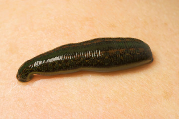 Medicinal Leech-hirudo medicinalis