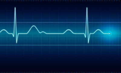 ECG Signal