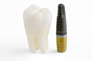 dental implantation