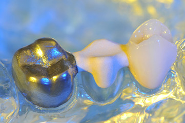 Macro shot of dramatically lightened dentist's equipments