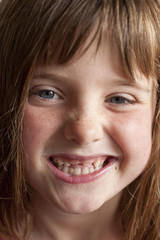 portrait little girl with two missing front teeth