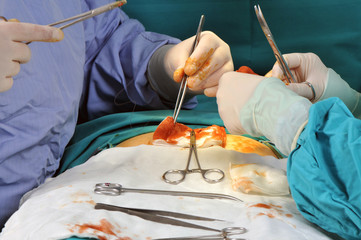 Closeup of a surgeon team performing an operation.