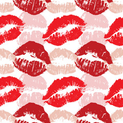 Cyclic kiss background