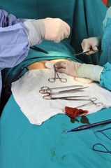 Closeup of a medical team performing an operation
