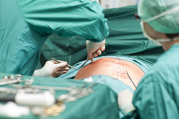 Schl&uuml;ssellochchirurgie