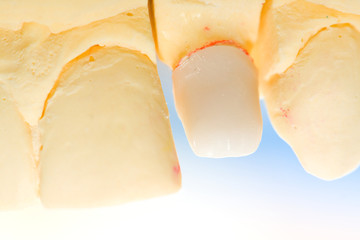 Dental zirconia for ceramics