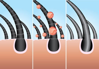 Illustration of three phase of hair cure, vector