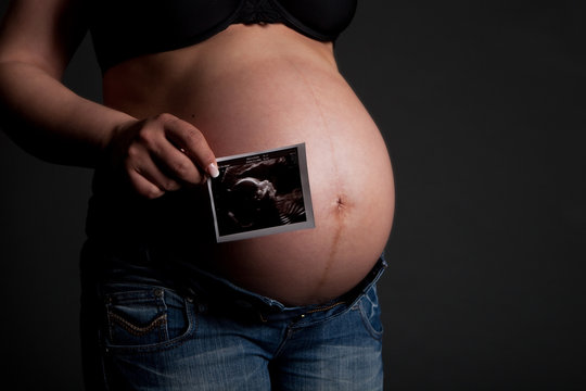 Pregnant woman showing a ultrasonic picture