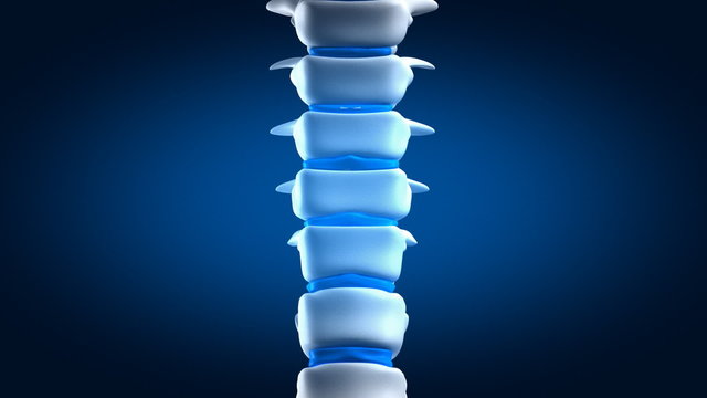 Human backbone closeup with spinal plates
