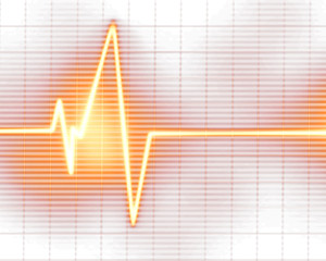 Heart monitor