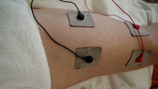 Elettrostimolatore 02 04 10