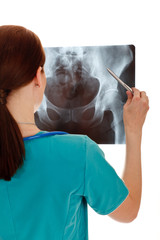 Rear view of young female doctor examining the x-ray image
