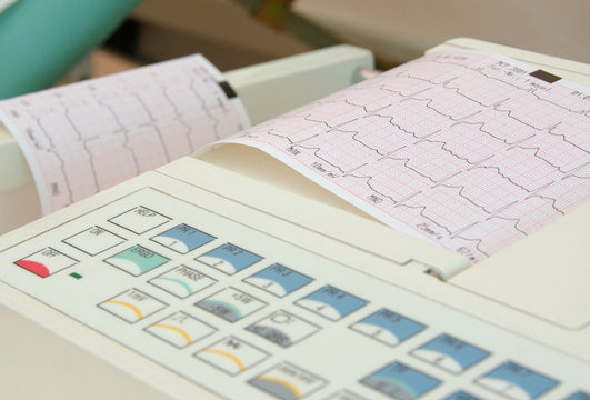 EKG - Elektrokardiogram