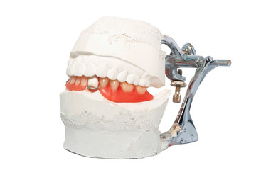 Dental Lab Articulator with dental prosthesis