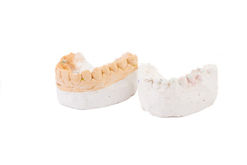 teeth plaster cast. Close up on white background