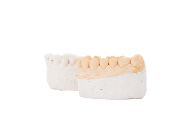 teeth plaster cast. Close up on white background