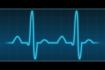EKG III