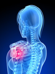 schmerzende Schultergelenk