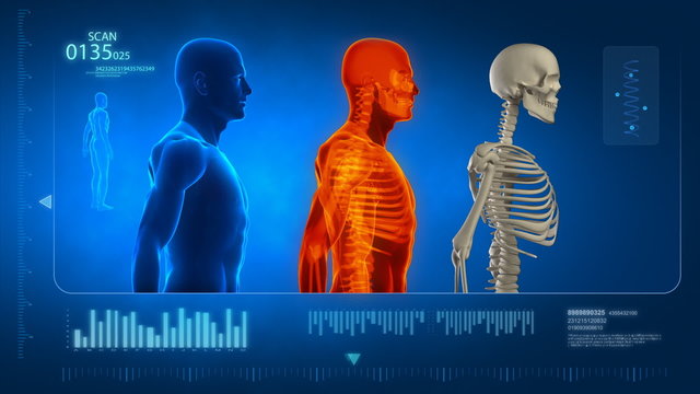 Medical display in loop - skeleton and x-ray