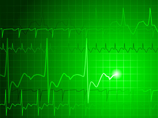 EKG background