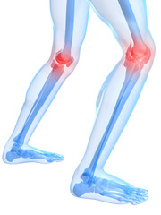 rot markierte Kniegelenke