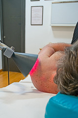 Terapia al laser