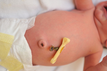 Le cordon ombilical du bébé tombe en moyenne dans sa 2eme semaine de vie
