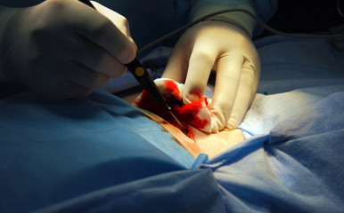 Surgery. Cancer ill women operation