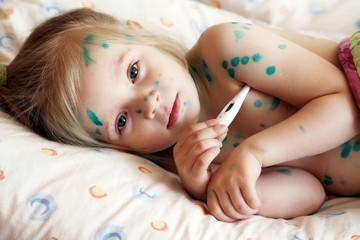 Girl suffers chickenpox